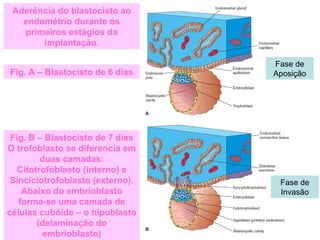 Aderência do blastocisto ao
endométrio durante os
primeiros estágios da
implantação.
Fig. A – Blastocisto de 6 dias
Fig. B – Blastocisto de 7 dias
O trofoblasto se diferencia em
duas camadas:
Citotrofoblasto (interno) e
Sinciciotrofoblasto (externo).
Abaixo do embrioblasto
forma-se uma camada de
células cubóide – o hipoblasto
(delaminação do
embrioblasto)
Fase de
Aposição
Fase de
Invasão
 