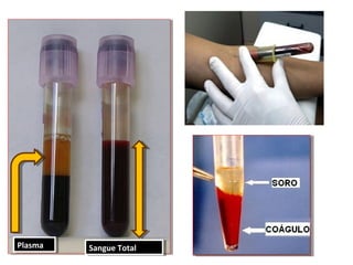 PlasmaPlasma Sangue TotalSangue Total
 