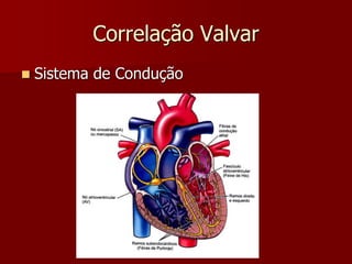 Correlação Valvar
 Sistema de Condução
 