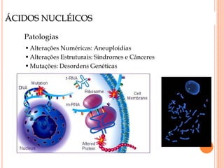 ÁCIDOS NUCLÉICOS
Patologias
 Alterações Numéricas: Aneuploidias
 Alterações Estruturais: Síndromes e Cânceres
 Mutações: Desordens Genéticas
 
