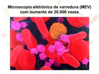 Microscopia eletrônica de varredura (MEV)
com aumento de 20.000 vezes
 