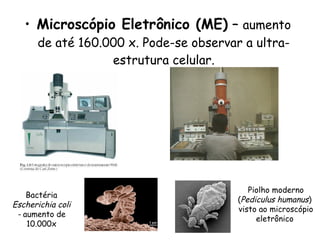 • Microscópio Eletrônico (ME) – aumento
de até 160.000 x. Pode-se observar a ultra-
estrutura celular.
Bactéria
Escherichia coli
- aumento de
10.000x
Piolho moderno
(Pediculus humanus)
visto ao microscópio
eletrônico
 