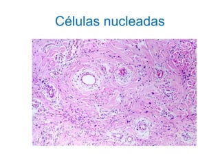 Células nucleadas
 