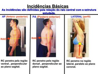 Incidências Básicas

As incidências são definidas pela relação do raio central com a estrutura
estudada.
AP (Antero- posterior)
LATERAL (perfil)
PA (Postero-anterior)

RAIO

RC penetra pela região
ventral , perpendicular
ao plano sagital.

RAIO

RC penetra pela região
dorsal , perpendicular ao
plano sagital.

RAIO
RC penetra na região
lateral, paralelo ao plano
coronal.

 