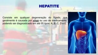 Consiste em qualquer degeneração do fígado, que
geralmente é causada por vírus ou uso de medicamento,
podendo ser diagnosticado em até 05 tipos: A, B, C, D e E.
HEPATITE
 