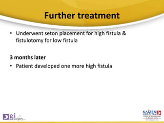 Further treatment
• Underwent seton placement for high fistula &
fistulotomy for low fistula
3 months later
• Patient developed one more high fistula
 