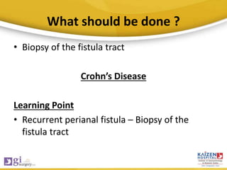 What should be done ?
• Biopsy of the fistula tract
Crohn’s Disease
Learning Point
• Recurrent perianal fistula – Biopsy of the
fistula tract
 