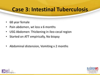 Case 3: Intestinal Tuberculosis
• 68 year female
• Pain abdomen, wt loss x 6 months
• USG Abdomen: Thickening in ileo-cecal region
• Started on ATT empirically, No biopsy
• Abdominal distension, Vomiting x 2 months
 