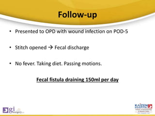Follow-up
• Presented to OPD with wound infection on POD-5
• Stitch opened  Fecal discharge
• No fever. Taking diet. Passing motions.
Fecal fistula draining 150ml per day
 