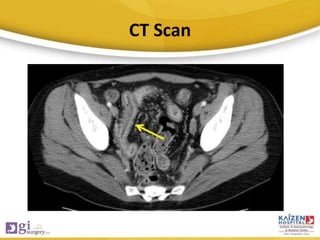 CT Scan
 
