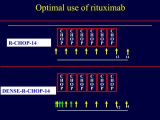 Optimal use of rituximab C H O P C H O P C H O P C H O P C H O P C H O P DENSE-R-CHOP-14 12 14 C H O P C H O P C H O P C H O P C H O P C H O P 12 14 R-CHOP-14 