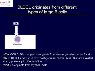 DLBCL originates from different  types of large B cells GCB ABC-like DLBCL PMBL The GCB DLBCLs appear to originate from normal germinal center B cells,  ABC DLBCLs may arise from post-germinal center B cells that are arrested during plasmacytic differentiation.  PMBLs originate from thymic B cells 