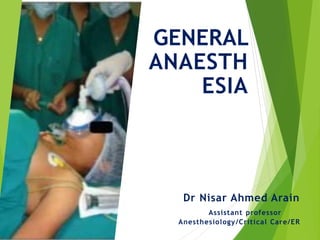 GENERAL
ANAESTH
ESIA
Dr Nisar Ahmed Arain
Assistant professor
Anesthesiology/Critical Care/ER
 