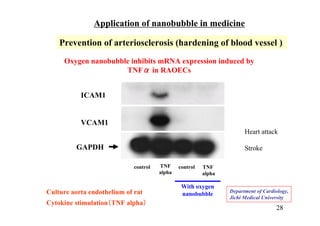 control TNF
alpha
With oxygen
nanobubble
control TNF
alpha
Prevention of arteriosclerosis (hardening of blood vessel )
Oxygen nanobubble inhibits mRNA expression induced by
TNFα in RAOECs
ICAM1
VCAM1
GAPDH
Department of Cardiology,
Jichi Medical University
Application of nanobubble in medicine
Culture aorta endothelium of rat
Cytokine stimulation（TNF alpha）
Heart attack
Stroke
28
 