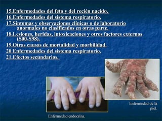 15.Enfermedades del feto y del recién nacido.   16.Enfermedades del sistema respiratorio. 17.Síntomas y observaciones clínicas o de laboratorio anormales no clasificados en otras parte.   18.Lesiones, heridas, intoxicaciones y otros factores externos (S00-S98). 19.Otras causas de mortalidad y morbilidad. 20 . Enfermedades del sistema respiratorio. 21.Efectos secundarios.   Enfermedad endocrina. Enfermedad de la piel. 