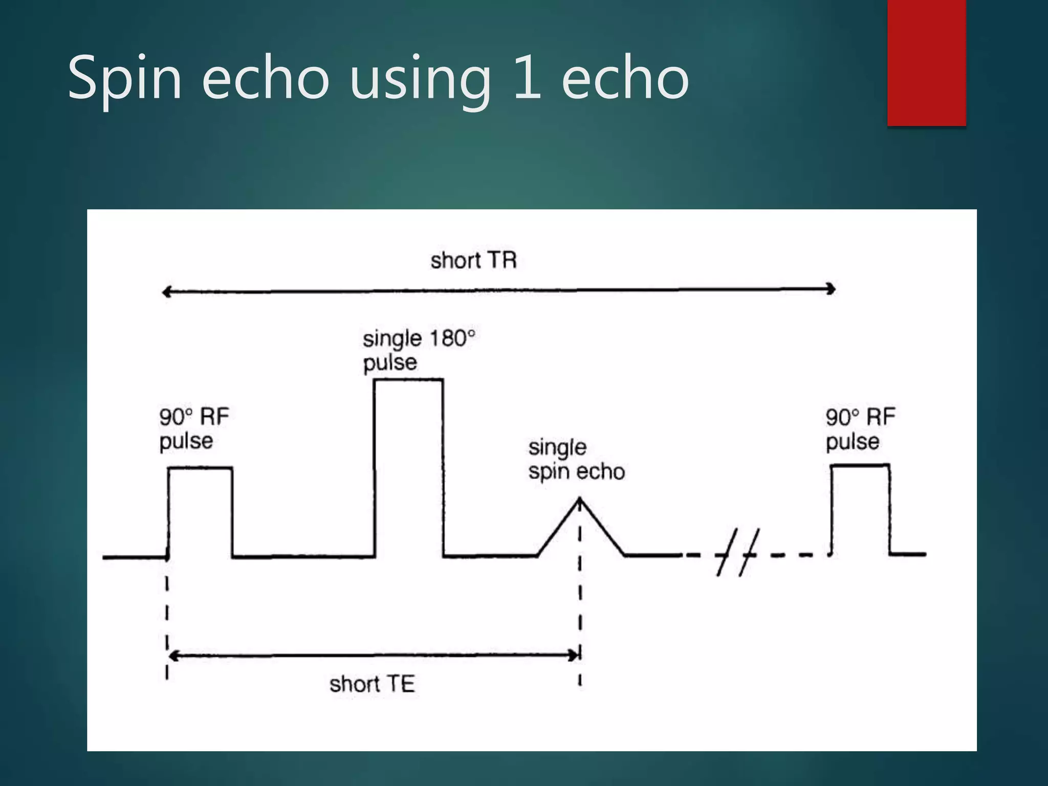 Spin echo using 1 echo
 