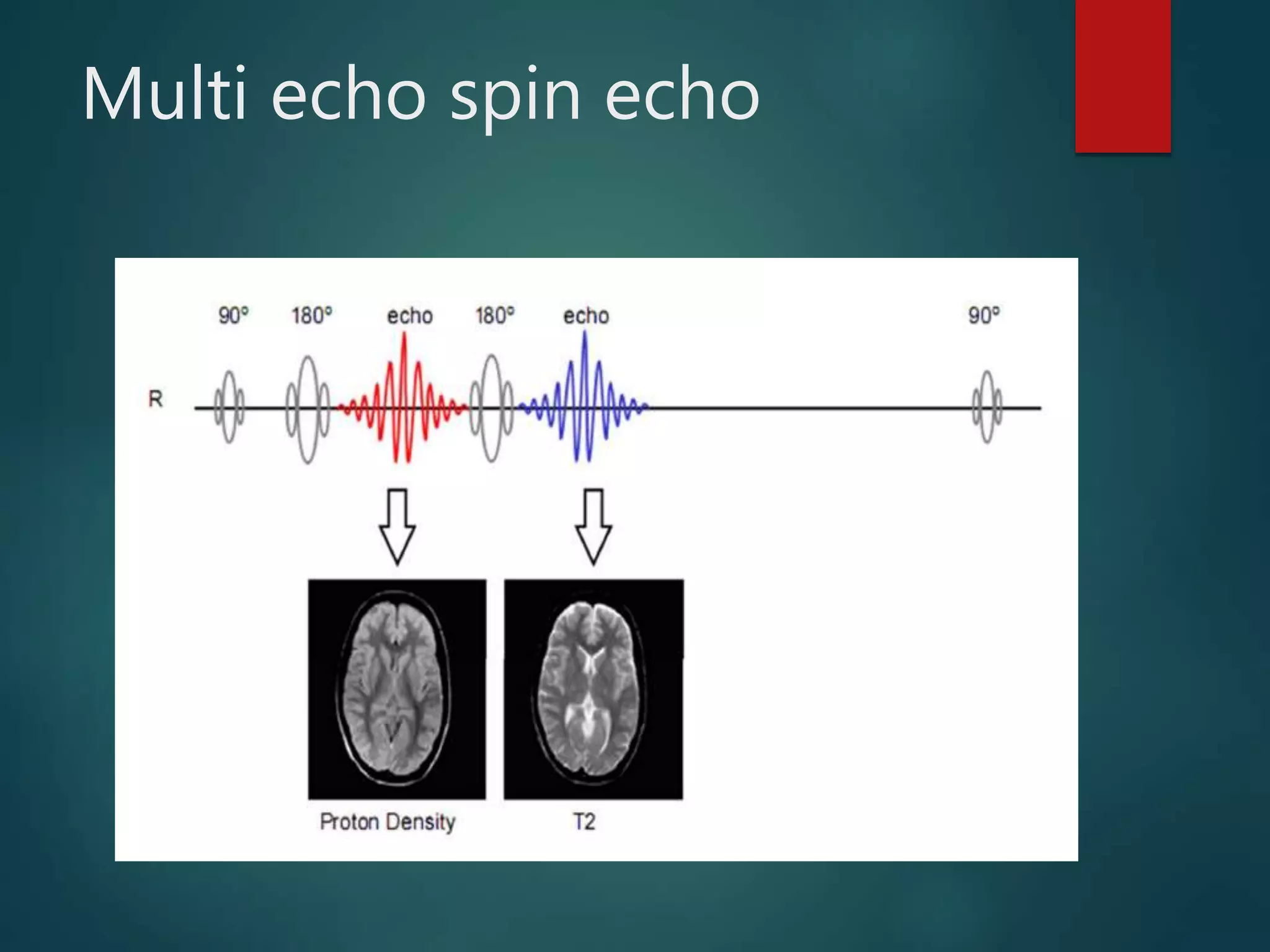 Multi echo spin echo
 
