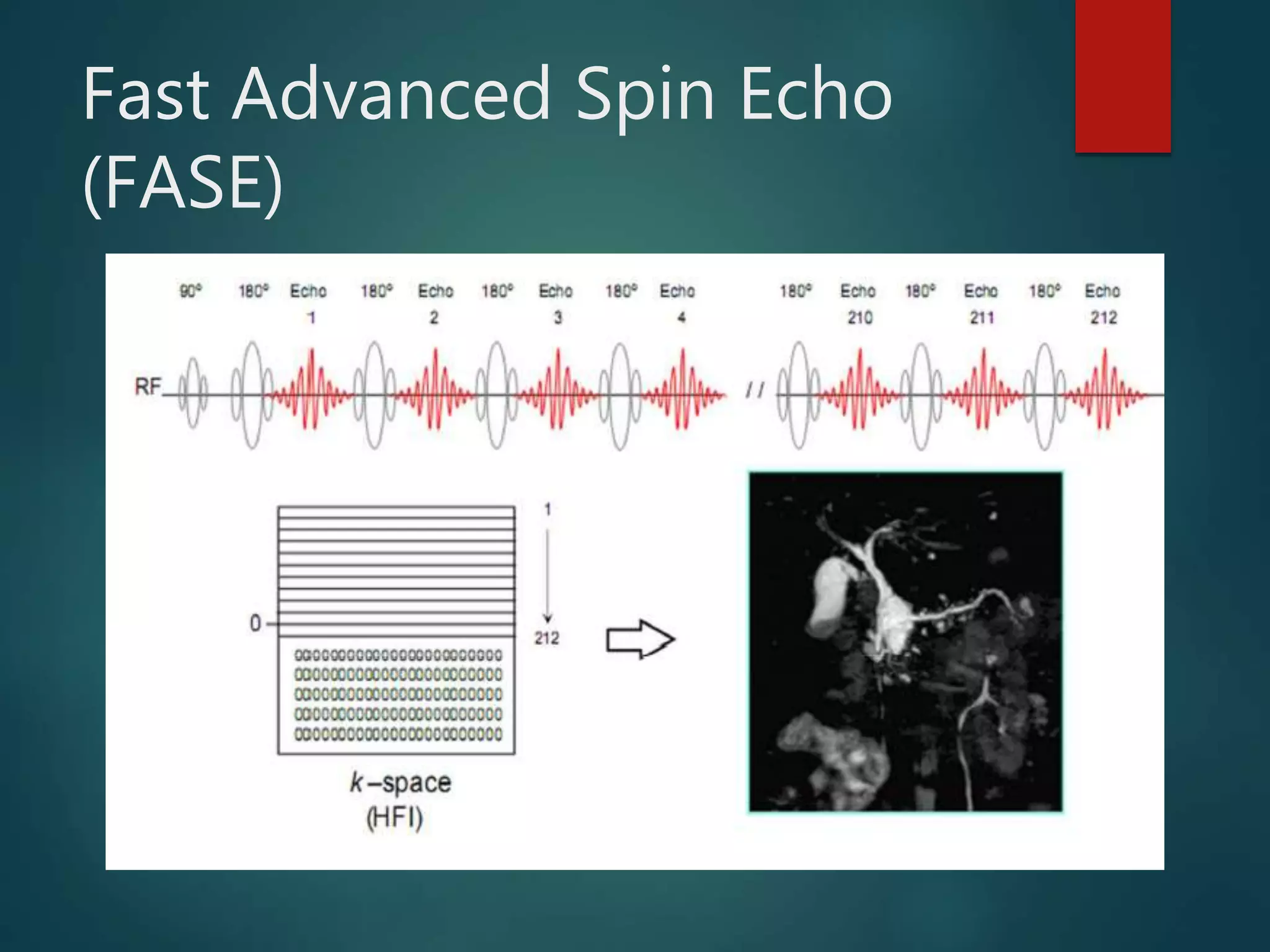 Fast Advanced Spin Echo
(FASE)
 