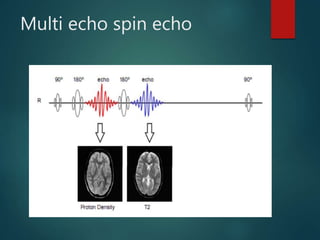 Multi echo spin echo
 
