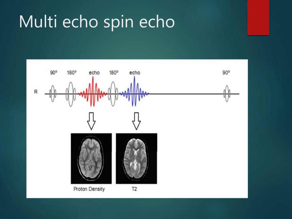 Basic Pulse Sequences In MRI