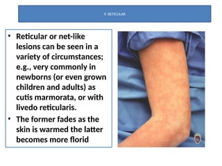 Introduction to basic skin lesion_PharmD.pptx