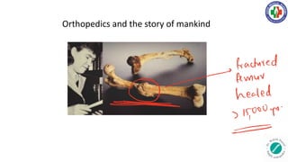 Orthopedics and the story of mankind
fractured
femur
healed
Its
15,0009
 