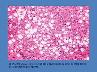 EL CAMBIO GRASO: se caracteriza por la acumulación de gotas de grasa dentro 
de las células del parénquima. 
 