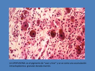 LA LIPOFUSCINA: es el pigmento de “usar y tirar” y se ve como una acumulación 
intracitoplásmica granular dorada-marrón. 
 