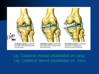 Lig. Colateral medial estabilidad en valgo
Lig. Colateral lateral estabilidad en Varo
 