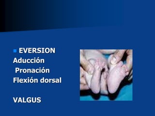  EVERSION
Aducción
Pronación
Flexión dorsal
VALGUS
 