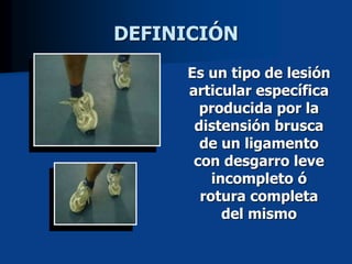DEFINICIÓN
Es un tipo de lesión
articular específica
producida por la
distensión brusca
de un ligamento
con desgarro leve
incompleto ó
rotura completa
del mismo
 