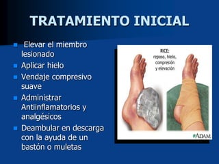 TRATAMIENTO INICIAL
 Elevar el miembro
lesionado
 Aplicar hielo
 Vendaje compresivo
suave
 Administrar
Antiinflamatorios y
analgésicos
 Deambular en descarga
con la ayuda de un
bastón o muletas
 