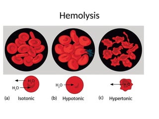 Hemolysis
 
