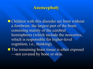 Brainless Child Brain Development | PPT