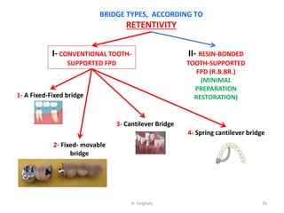 Comprehensive Guide to Classification and Types of Fixed Partial ...