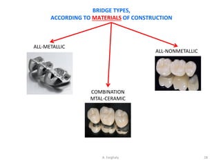 Comprehensive Guide to Classification and Types of Fixed Partial ...