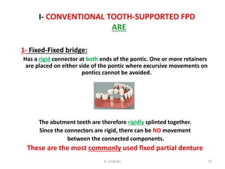 Comprehensive Guide to Classification and Types of Fixed Partial ...