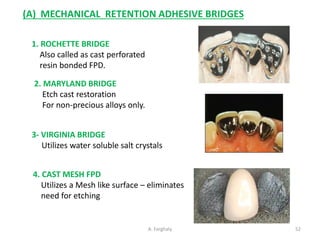 Comprehensive Guide to Classification and Types of Fixed Partial ...