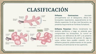 Enfisema Centroacinar: Asociado
principalmente con el tabaquismo, afecta los
bronquiolos respiratorios, especialmente en los
lóbulos superiores. Es el tipo más frecuente y se
presenta mayormente en hombres fumadores.
Enfisema Panacinar: Afecta inicialmente los
alvéolos periféricos y luego se extiende para
comprometer los bronquiolos. Es común en
personas con deficiencia de AAT y se presenta
en las partes inferiores del pulmón. En algunos
casos, ambos tipos pueden coexistir, con el
enfisema panacinar predominando en las partes
inferiores y el centroacinar en las superiores.
CLASIFICACIÓN
 