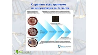 Скрининг всех хромосом
на анеуплоидии за 12 часов
 