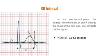 1 CARDIAC DYSARHYTHMIAS - INTERPRETATION.pptx