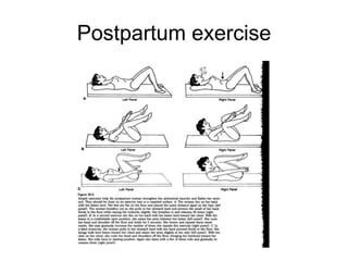 Post Delivery Exercise .pdf 1 care of postpartum | PPTX