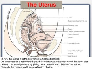 The Uterus 
In 75% the uterus is in the anteverted, anteflexed position. 
On rare occasion a retro-verted gravid uterus may get entrapped within the pelvis and 
beneath the sacral promontory, giving rise to anterior sacculatoin of the uterus. 
Clinically this presents with acute retention of urine. 
 
