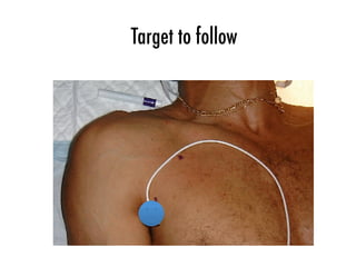 Chest port implant access and techniques. Luc Rotenberg 2018 | PDF