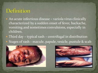Variola Rash Prevention and control of Chickenpox.pptx