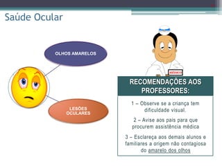 21
Saúde Ocular
OLHOS AMARELOS
LESÕES
OCULARES
MÉDICO
RECOMENDAÇÕES AOS
PROFESSORES:
1 – Observe se a criança tem
dificuldade visual.
2 – Avise aos pais para que
procurem assistência médica
3 – Esclareça aos demais alunos e
familiares a origem não contagiosa
do amarelo dos olhos
 