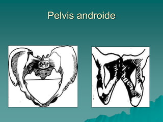 Pelvis androide
 