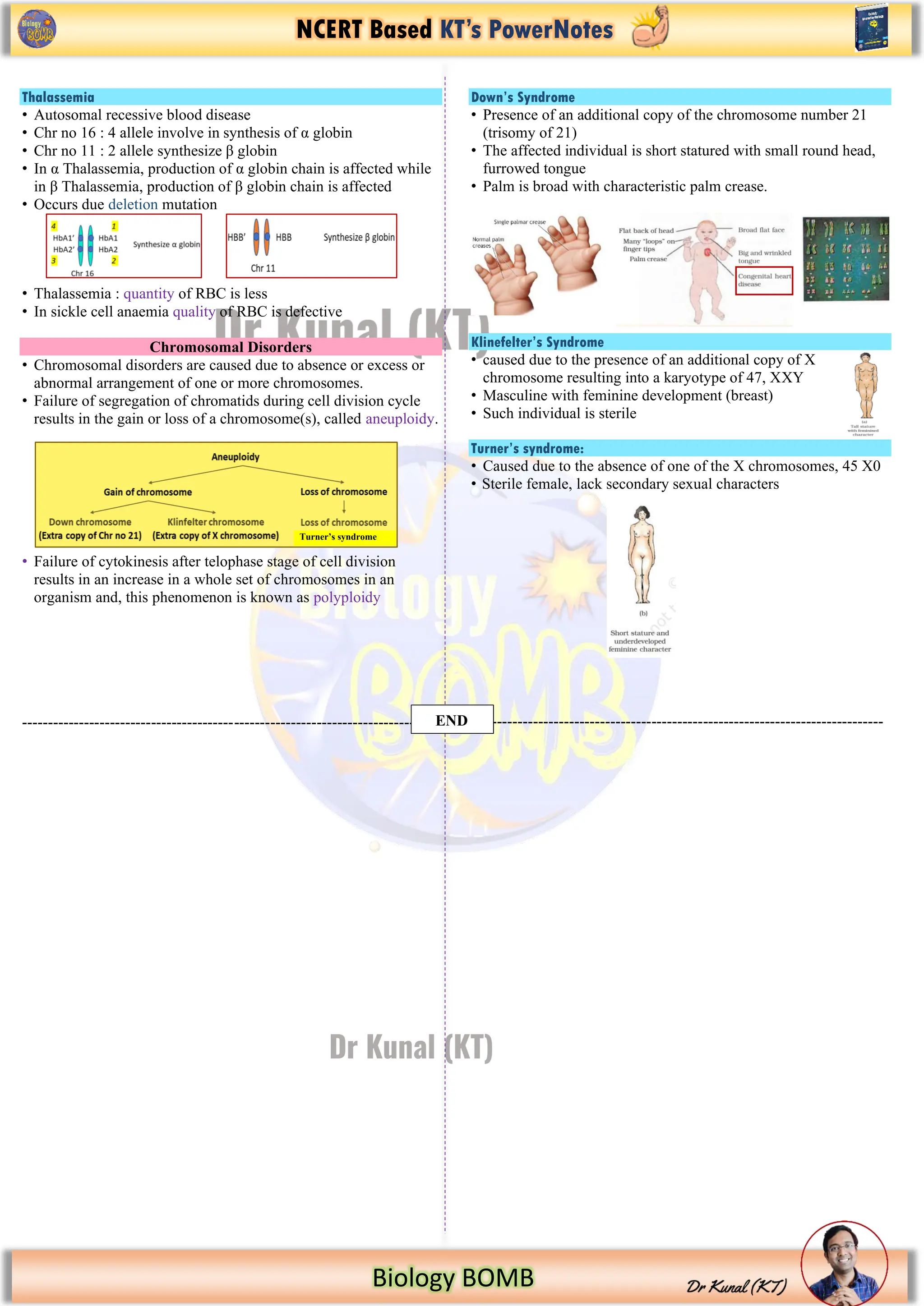 NCERT Based KT’s PowerNotes
Biology BOMB
Thalassemia
• Autosomal recessive blood disease
• Chr no 16 : 4 allele involve in synthesis of α globin
• Chr no 11 : 2 allele synthesize β globin
• In α Thalassemia, production of α globin chain is affected while
in β Thalassemia, production of β globin chain is affected
• Occurs due deletion mutation
• Thalassemia : quantity of RBC is less
• In sickle cell anaemia quality of RBC is defective
Chromosomal Disorders
• Chromosomal disorders are caused due to absence or excess or
abnormal arrangement of one or more chromosomes.
• Failure of segregation of chromatids during cell division cycle
results in the gain or loss of a chromosome(s), called aneuploidy.
• Failure of cytokinesis after telophase stage of cell division
results in an increase in a whole set of chromosomes in an
organism and, this phenomenon is known as polyploidy
-------------------------------------------------------------------------------
Down’s Syndrome
• Presence of an additional copy of the chromosome number 21
(trisomy of 21)
• The affected individual is short statured with small round head,
furrowed tongue
• Palm is broad with characteristic palm crease.
Klinefelter’s Syndrome
• caused due to the presence of an additional copy of X
chromosome resulting into a karyotype of 47, XXY
• Masculine with feminine development (breast)
• Such individual is sterile
Turner’s syndrome:
• Caused due to the absence of one of the X chromosomes, 45 X0
• Sterile female, lack secondary sexual characters
--------------------------------------------------------------------------------
END
Turner’s syndrome
 