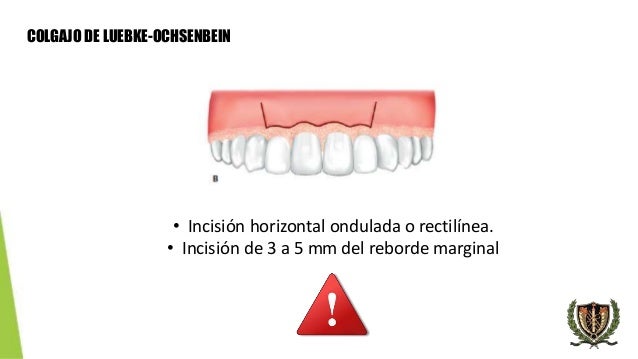 Resultado de imagen para tipos de incisiones en odontologia Colgajo de Luebke-Ochsenbein: