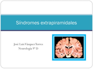 José LuisVázquezTorres
Neurología 9º D
Síndromes extrapiramidales
 